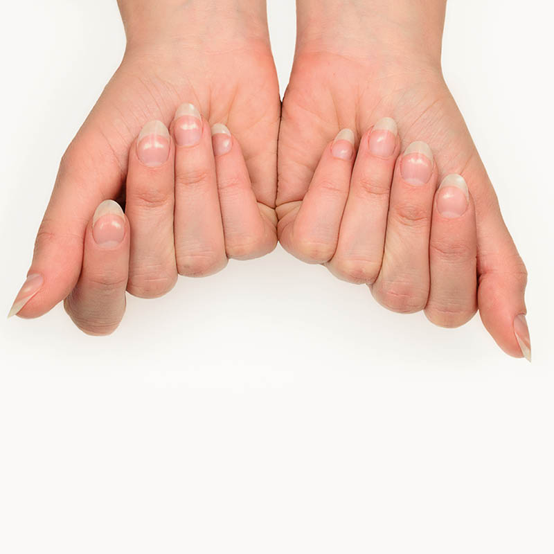 Your Nails Help Diagnose Nutrient Deficiencies - YouTube