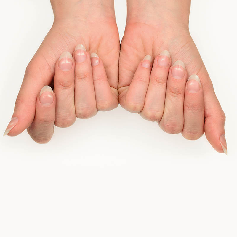 White Spots on Your Nails? Think Zinc Deficiency - HealthPost NZ