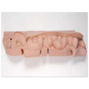 Louise Bourgeois  MAMELLES 1991 Aluminum Print