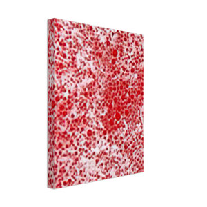 Yayoi Kusama  BEYOND THE END OF THE CENTURY 1987 Canvas