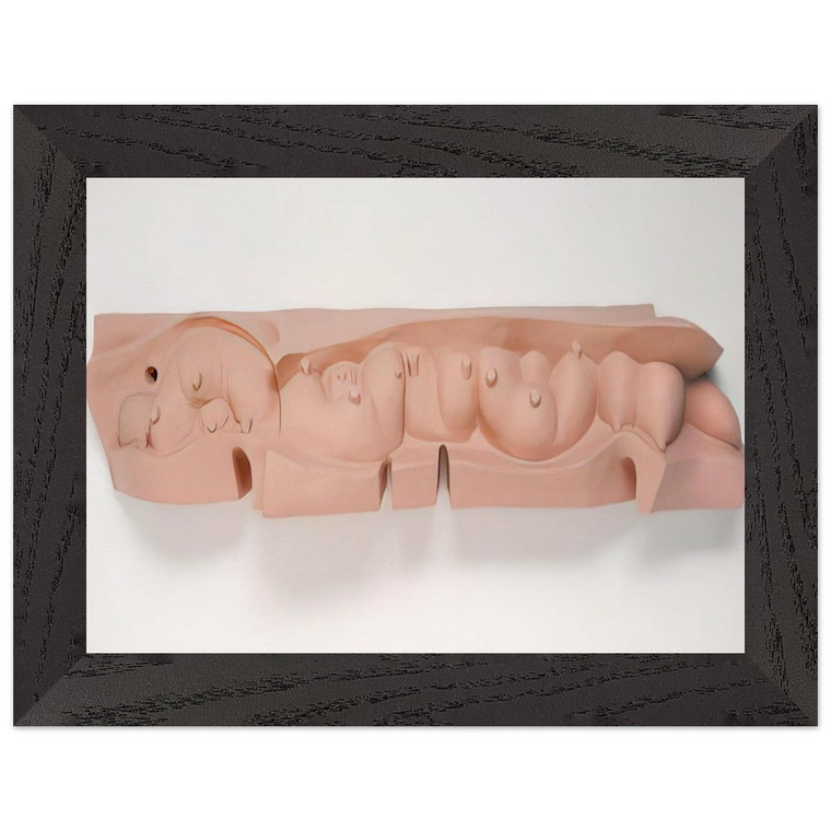 Louise Bourgeois  MAMELLES 1991 Premium Wooden Framed Art Print / Poster