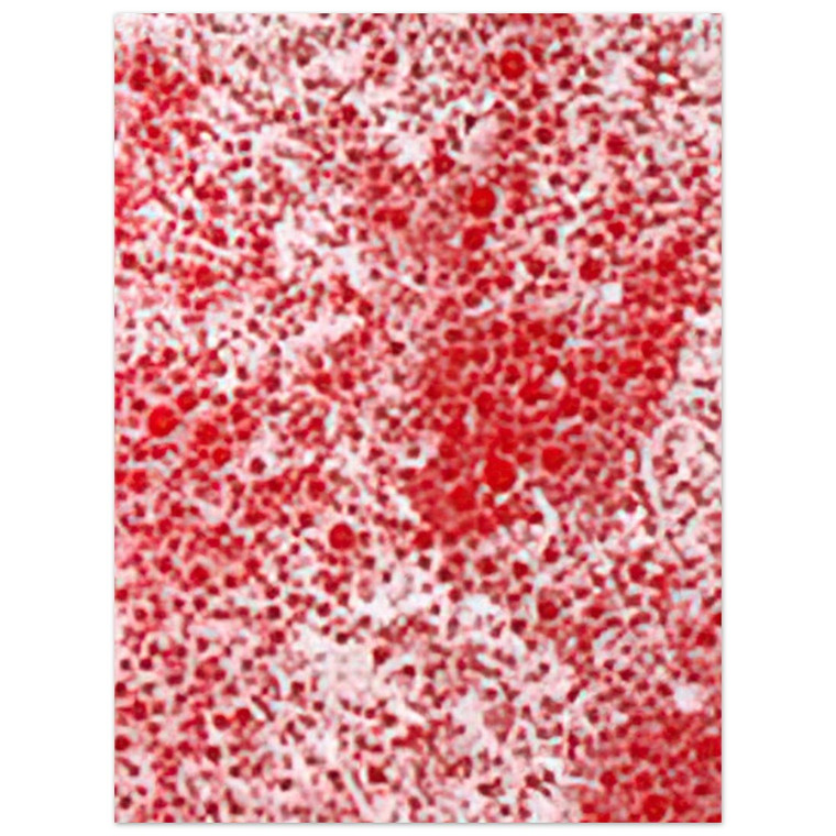 Yayoi Kusama  BEYOND THE END OF THE CENTURY 1987 Aluminum Print