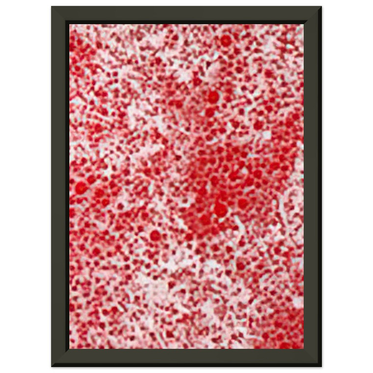 Yayoi Kusama BEYOND THE END OF THE CENTURY 1987 Metal Framed Print