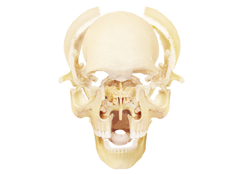 4D Human Anatomy Exploded Skull- Damaged Package