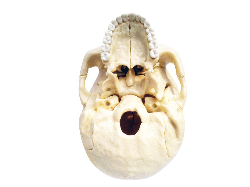 4D Human Anatomy Exploded Skull- Damaged Package