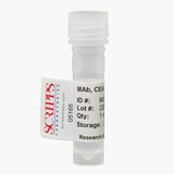 Carcinoembryonic Antigen (CEA) Monoclonal Antibody