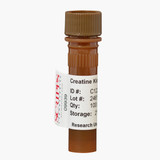 Creatine Kinase MB (CK-MB)