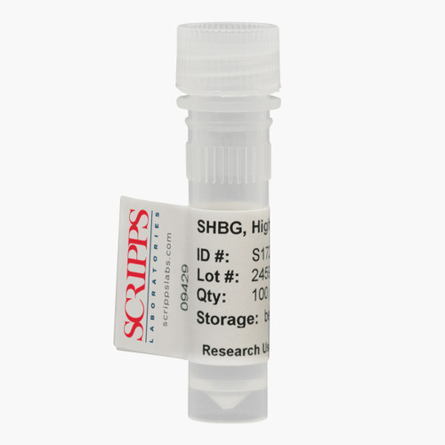 Plasma Proteins Sex Hormone Binding Globulin Shbg 3014