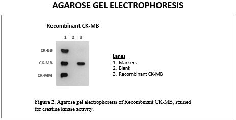 rec-ckmb-gelelectrophoresis3.jpg