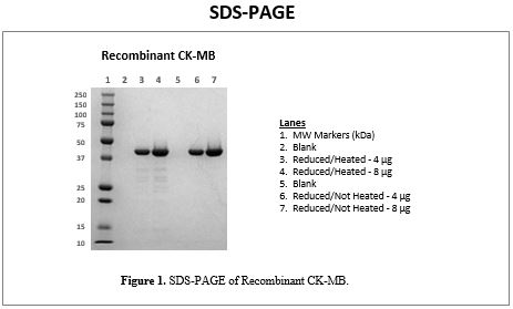 rec-ckmb-sds-page.jpg