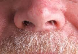 Nose