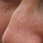 Nose