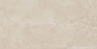 Valencia Beige 12" x 24"