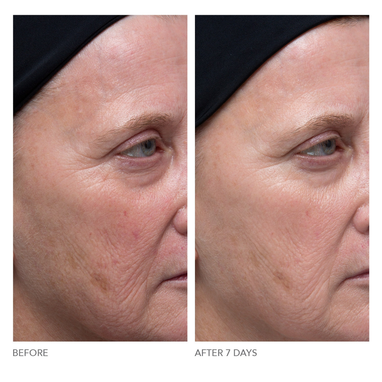 Dr Dennis Gross C Collagen Brighten Firm Vitamin C Serum