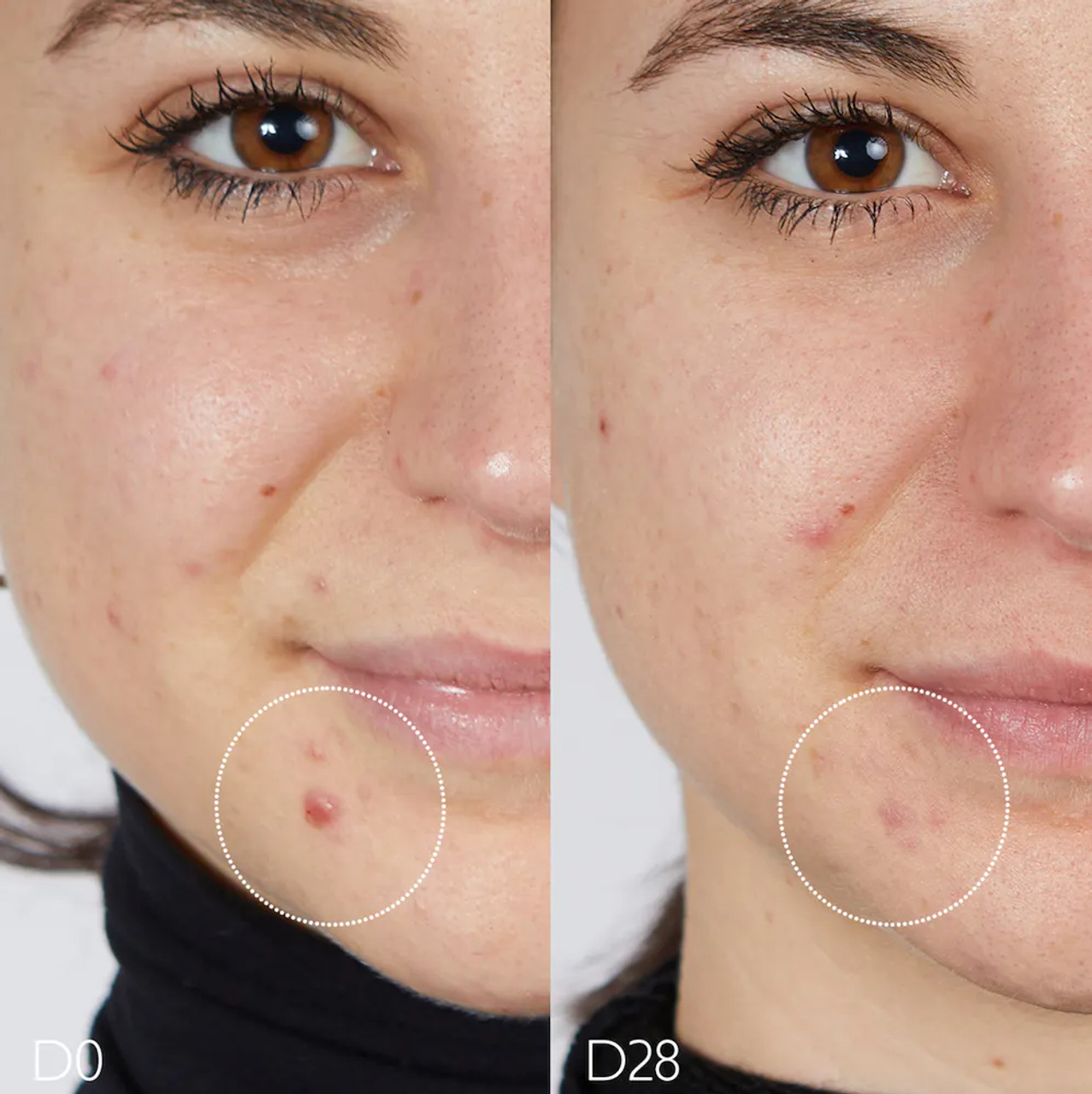 Caudalie Vinopure Skincare for Acne: The Review - Escentual's Blog