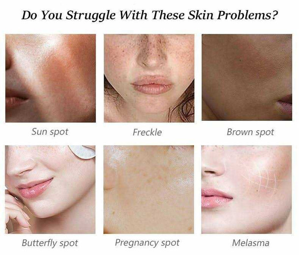 Kojic Acid Collagen Skin Whitening Facial Soap