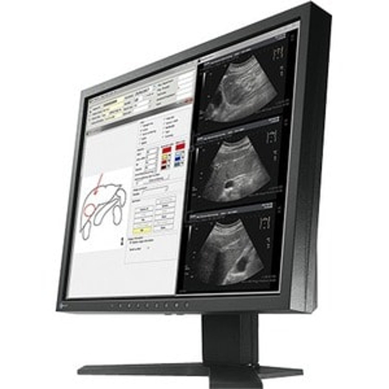 EIZO RadiForce MX194 18.9" SXGA LED LCD Monitor