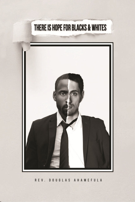 There Is Hope for Blacks & Whites