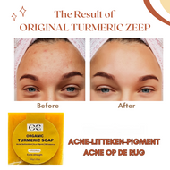  Acne & Pigmentvlekken Verlichten met Turmeric & Anti-Spot Crème