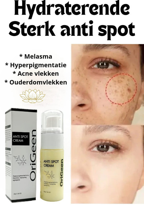 Origeen Organic Anti-Spot Crème – tegen hyperpigmentatie en melasma