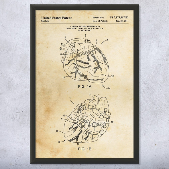 Human Heart Patent Wall Art