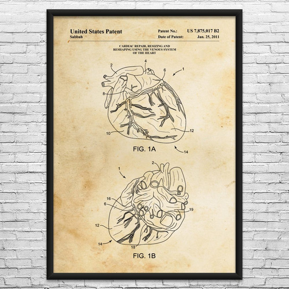 Human Heart Patent Wall Art