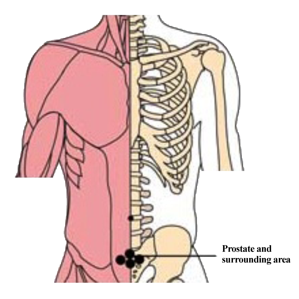 os-pro-prostate-tlc-points-tachyon-products.png os-pro-prostate-tlc-points-tachyon-products.png