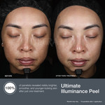Ultimate Illuminance Peel 60ml
