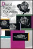Rafael C. Gonzalez / Digital Image Processing (Hardback)