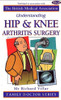 Richard N. Villar / Understanding Hip and Knee Arthritis Surgery