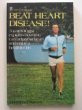 Risteard Mulcahy / Beat Heart Disease (Large Paperback)
