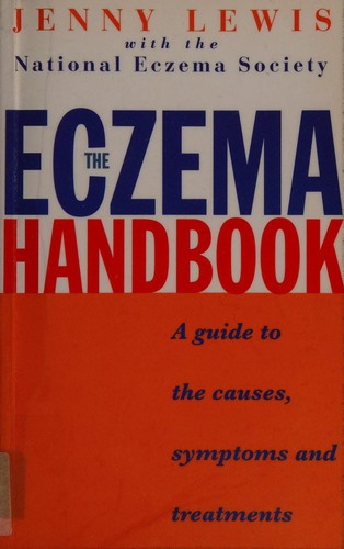 Jenny Lewis / The Eczema Handbook (Large Paperback)
