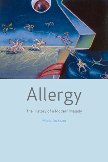 Mark Jackson / Allergy: The History of a Modern Malady (Hardback)