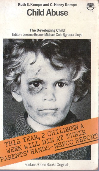Ruth S. Kempe / Child Abuse (Vintage Paperback)