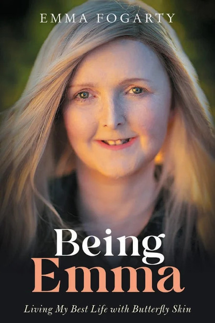 Emma Fogarty - Being Emma : Living My Best Life with Butterfly Skin - PB