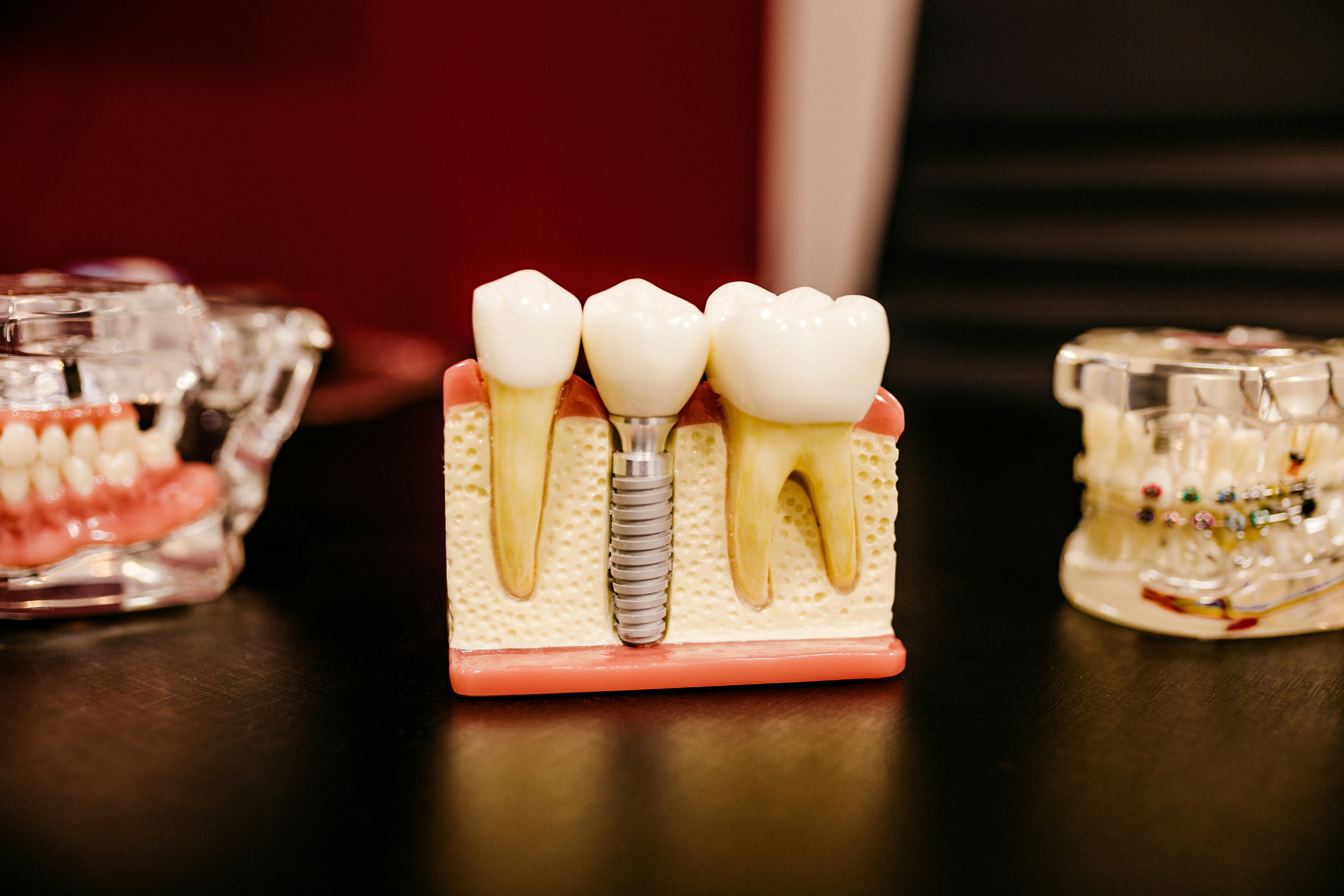 Dental Equipment