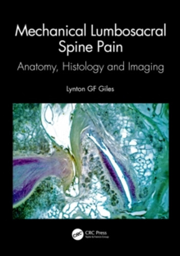 Mechanical Lumbosacral Spine Pain 9781032326436 Paperback