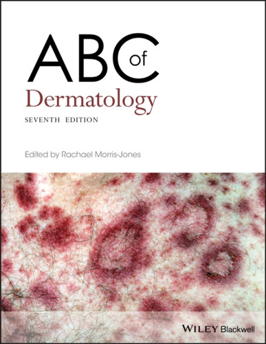 ABC of Dermatology 9781119488989 Paperback ABC of Dermatology 9781119488989 Paperback