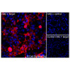 Immunofluorescence, Extracellular: (Left) COS-7 cells transiently transfected Chikungunya Virus E1/E2 were stained with Chikungunya Virus E1/E2 Monoclonal Antibody (CSB0125) followed by AlexaFluor 647 anti-Mouse IgG secondary antibody (red) and DAPI (blue). (Top right) COS-7 cells transiently transfected with an empty control vector stained with Chikungunya Virus E1/E2 Monoclonal Antibody. (Bottom right) Isotype control: COS-7 cells transfected with Chikungunya Virus E1/E2 and stained with control MAb.