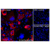 Immunofluorescence, Intracellular: (Left) COS-7 cells transiently transfected Chikungunya Virus E1/E2 were permeabilized and stained with Chikungunya Virus E1/E2 Monoclonal Antibody (CSB0125) followed by AlexaFluor 647 anti-Mouse IgG secondary antibody (red) and DAPI (blue). (Top right) COS-7 cells transiently transfected with an empty control vector stained with Chikungunya Virus E1/E2 Monoclonal Antibody. (Bottom right) Isotype control: COS-7 cells transfected with Chikungunya Virus E1/E2 and stained with control MAb.
