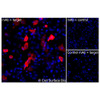 Immunofluorescence, Intracellular: (Left) JS-1 cells transiently transfected human IL6R were permeabilized and stained with IL6R Monoclonal Antibody (CSB0072) followed by AlexaFluor 647 anti-Mouse IgG secondary antibody (red) and DAPI (blue). (Top right) JS-1 cells transiently transfected with an empty control vector stained with IL6R Monoclonal Antibody. (Bottom right) Isotype control: JS-1 cells transfected with human IL6R and stained with control MAb.