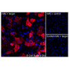 Immunofluorescence, Extracellular: (Left) JS-1 cells transiently transfected human CXCR7 were stained with CXCR7 Monoclonal Antibody (CSB0095) followed by AlexaFluor 647 anti-Mouse IgG secondary antibody (red) and DAPI (blue). (Top right) JS-1 cells transiently transfected with an empty control vector stained with CXCR7 Monoclonal Antibody. (Bottom right) Isotype control: JS-1 cells transfected with human CXCR7 and stained with control MAb.