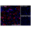 Immunofluorescence, Intracellular: (Left) JS-1 cells transiently transfected human PTHR1 were permeabilized and stained with PTHR1 Monoclonal Antibody (CSB0053) followed by AlexaFluor 647 anti-Mouse IgG secondary antibody (red) and DAPI (blue). (Top right) JS-1 cells transiently transfected with an empty control vector stained with PTHR1 Monoclonal Antibody. (Bottom right) Isotype control: JS-1 cells transfected with human PTHR1 and stained with control MAb.