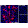 Immunofluorescence, Intracellular: (Left) JS-1 cells transiently transfected GPRC5D were permeabilized and stained with GPRC5D Monoclonal Antibody (CSB0219) followed by AlexaFluor 647 anti- IgG secondary antibody (red) and DAPI (blue). (Top right) JS-1 cells transiently transfected with an empty control vector stained with GPRC5D Monoclonal Antibody. (Bottom right) Isotype control: JS-1 cells transfected with {{target} and stained with control MAb.