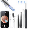 Ear Wax Removal, Ear Cleaner with Camera and Light, FSA HSA Eligible - Black