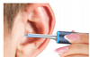 BEBIRD SMART OTOSCOPES BEBIRD M9 S EAR CLEANING WAX REMOVAL DEVICE - BLACK