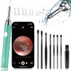 Ear Wax Removal Tool, Smart Ear Cleaner, Ear Camera Scope with Light Smartphone