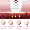 ALCYONEUS IPL-WHITE HAIR REMOVAL FOR WOMEN PERMANENT, AT-HOME LASER HAIR REMOVAL