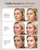 SKB-2418 INDOCTOR XSSNVV RED LIGHT THERAPY FOR FACE 4 MODE CORDLESS LED MASK
