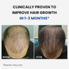 ForHair - Men Hair Growth Spray - Stimulates, Strengthens, No Unwanted Body Hair New